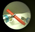 CELTS view through laparoscope