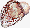 NURBS model of heart